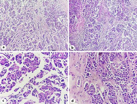 Figure 1 From Correlative Evaluation Of Seven Cytological 3 Tier