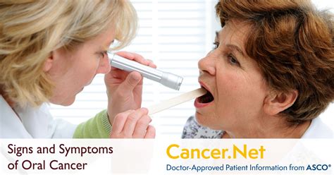 Oral And Oropharyngeal Cancer Symptoms And Signs Cancernet