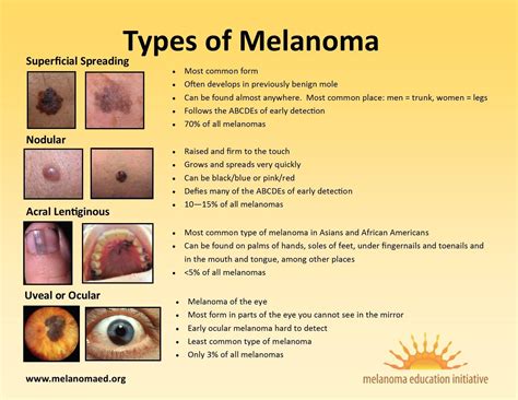 Tratamiento del melanoma tipos etapas diagnóstico factores de riesgo