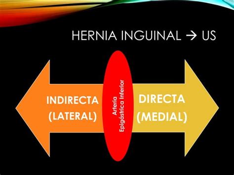 Hernia Inguinal Imagenologia Ppt