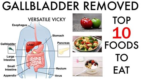 10 Gallbladder Foods Foods To Eat After Gallbladder Removal Surgery