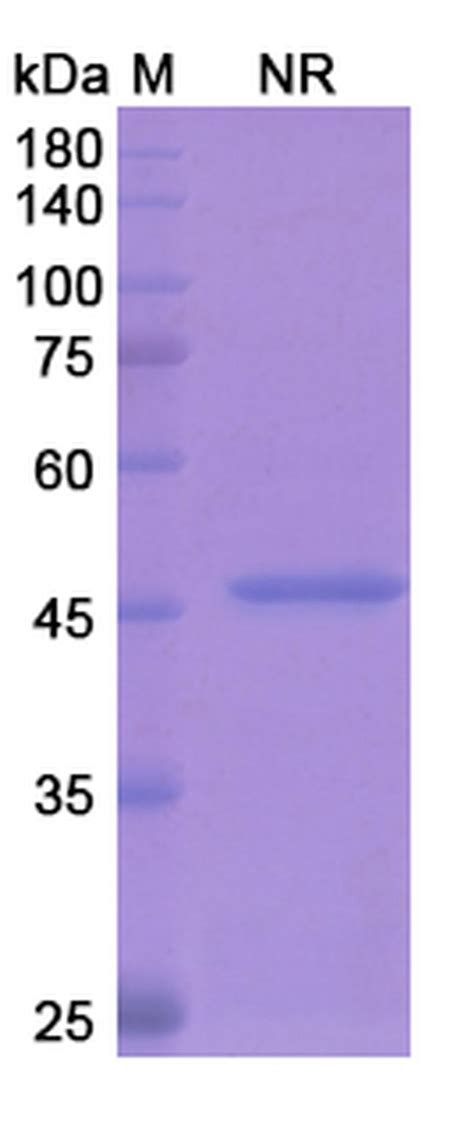 Ranibizumab Recombinant Monoclonal Antibody Ma5 41722