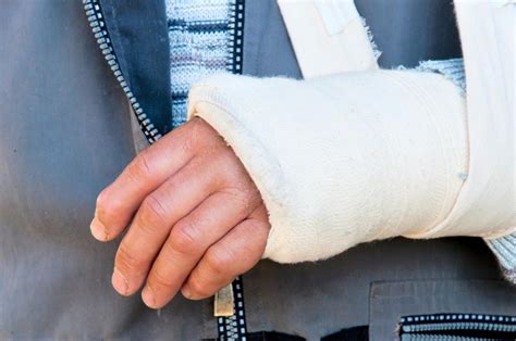 A Broken Wrist What To Expect From The Recovery Process Maryland