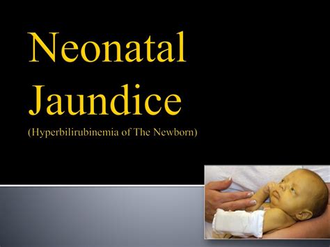 Ppt Neonatal Jaundice Hyperbilirubinemia Of The Newborn Powerpoint