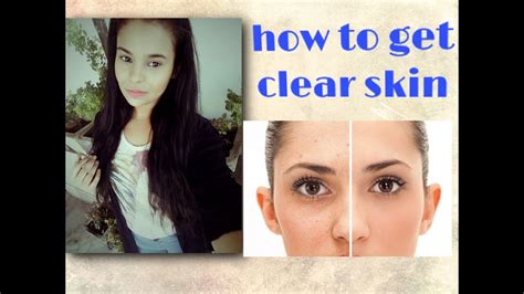 How To Get Clear Skin All You Want To Know Youtube