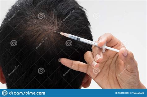 Pump an adequate amount of hair serum onto a palm of your hand. Doctor Inject Treatment Serum Vitamins Hair Fall Stock ...