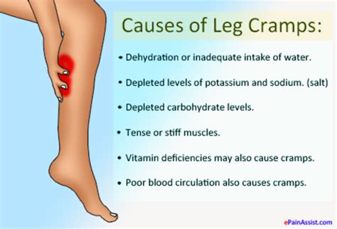 If Your Legs Cramp This Is The Reason Why And How To Prevent It From