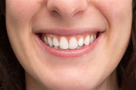 The Shape Of Your Two Front Teeth Can Tell About Your Personality