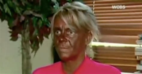 Tan Mom Patricia Krentcil Claims She Cut Down On Tanning