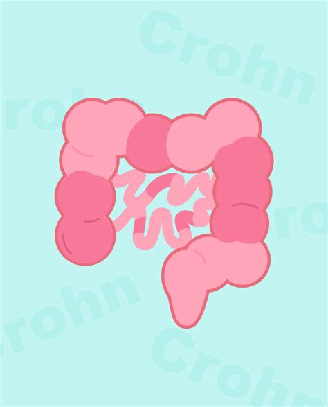 Crohns Disease Synappsehealth