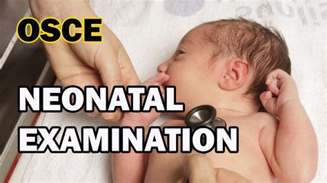 Neonatal Examination For Osce Youtube