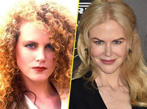Nicole Kidman Et La Chirurgie Esthétique - Photos : Chirurgie esthétique : Rhinoplastie : 28 avant/après de stars