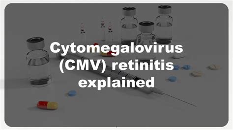 Cytomegalovirus Cmv Retinitis Explained Youtube