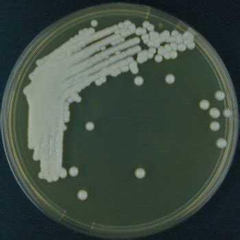 Cryptococcus neoformans affect immunocompetent persons but more often in patients with hiv/aids, tuberculosis, hematogenous malignancies, and hospitalized patients majorly those with. Cryptococcus neoformans