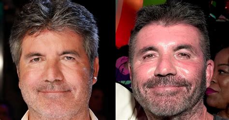 Simon Cowell Removes His Face Fillers After Saying He Went Too Far