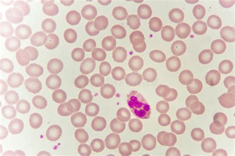 Neutrophil Cell Stock Photo Image Of Blood Laboratory 112054540