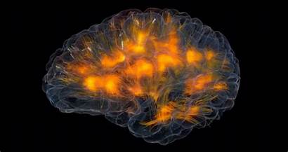 Brain Neuro Activity Neuroscience Adhd Mental Neuroplasticity