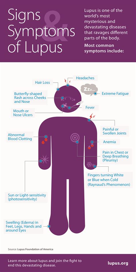 Help Your Doctor Diagnose Lupus Dr Pamela Ross The Socially