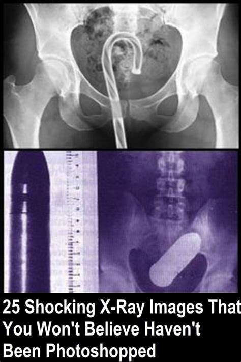 Throughout The Years There Have Been Tons Of X Rays Done Some Quite Normal And Others Extremely