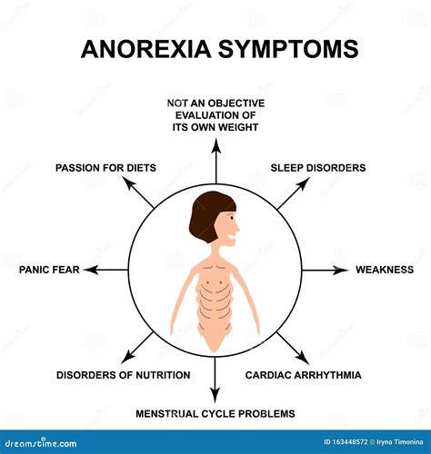 Síntomas De La Anorexia Físico Delgado Con Anorexia Infografía Ilustración De Vectores Sobre