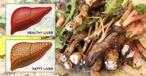 10 Powerful Foods That Naturally Cleanse Your Liver Healthy Holistic