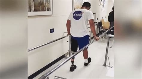 Nevada Doctor Leads Effort To Bring Amputees More Prosthetic Options