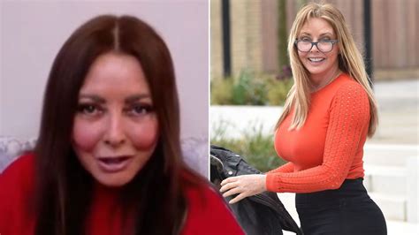 Carol Vorderman Finds It Sad That Some Fans Focus On Her Big Bottom