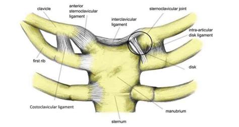 Sternoclavicular Sprain Symptoms Causes And Treatment