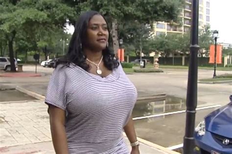 Woman Who Had Surgery To Reduce 36nnn Breasts Says I Couldnt Even