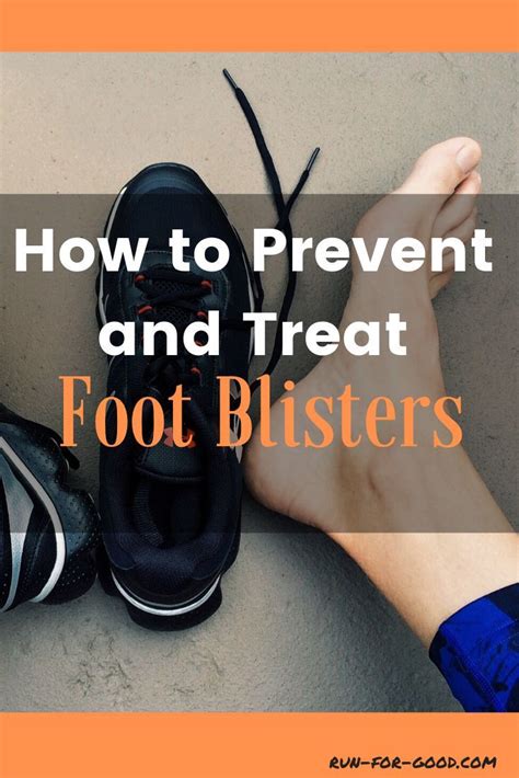 How To Prevent And Treat Foot Blisters Run For Good Running
