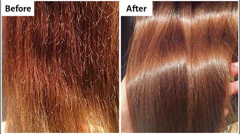 Details More Than 74 Types Of Hair Damage Best Ineteachers