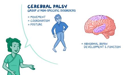 Cerebral Palsy Brain