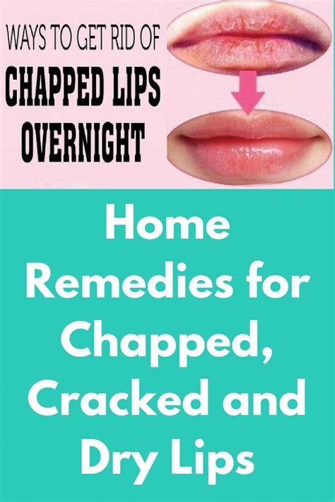 Home Remedies For Chapped Cracked And Dry Lips Today I Will Share A