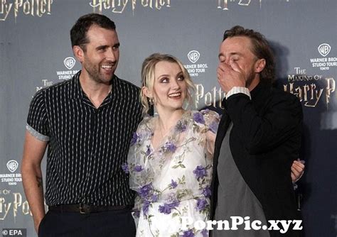 Harry Potter Star Evanna Lynch Shows Off Her Endless Legs From