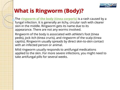 Ppt Ringworm Body Symptoms Causes And Treatment Powerpoint