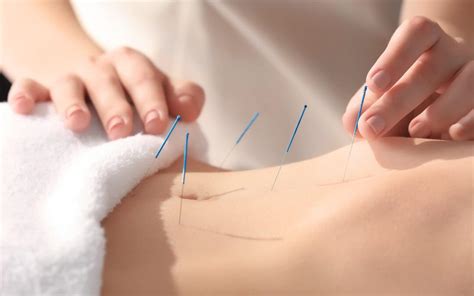 Acupuncture For Lower Back Pain Treatment Livewell Health And