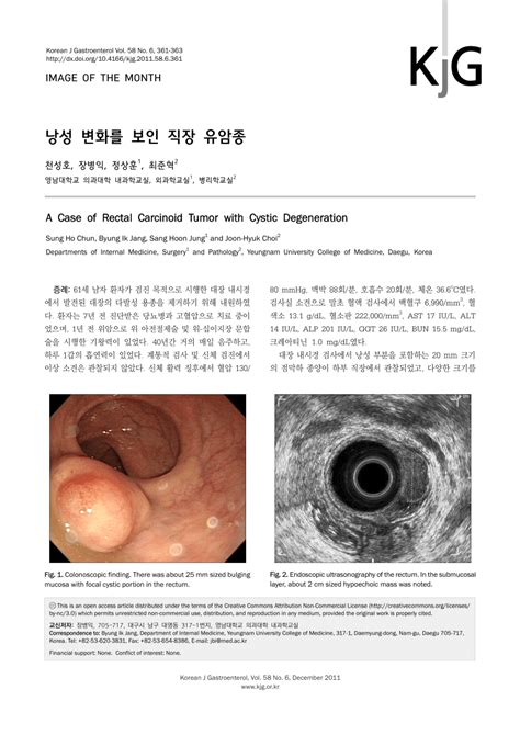 Pdf A Case Of Rectal Carcinoid Tumor With Cystic Degeneration