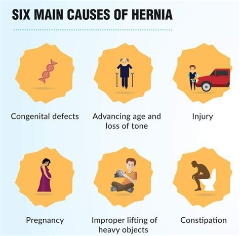 Hernia Treatment Doctor General Surgeon For Hernia