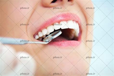 عکس با کیفیت دندان پزشک در حال معاینه دندان های زن با آینه گرد کوچک مخصوص دندان پزشکی عکس با