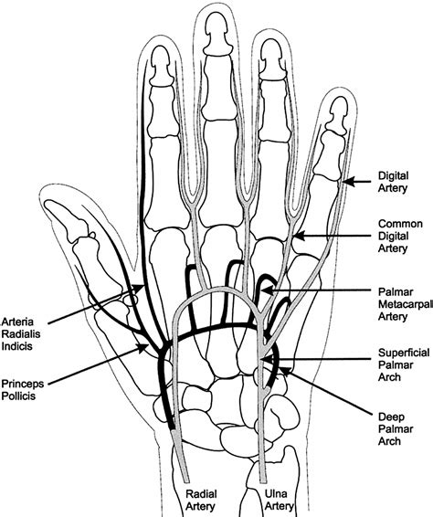 Contrast Enhanced Mr Angiography Of The Hand Radiographics