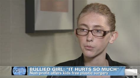Bullied Girl Receives Free Plastic Surgery To Pin Her Ears Is