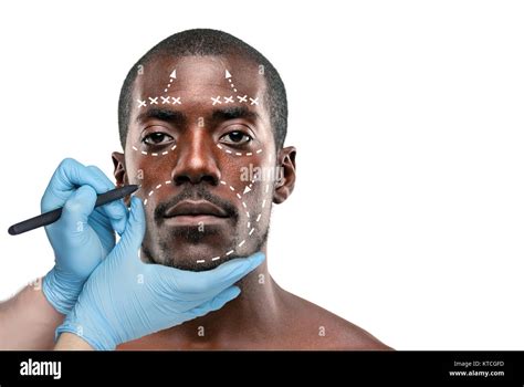 Man Face Surgery Marks Hi Res Stock Photography And Images Alamy