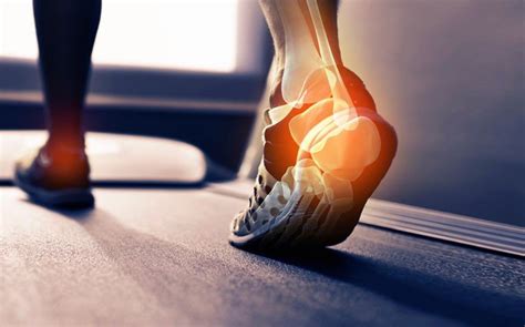 Causes Of Heel Pain From Running Symptoms And Treatment