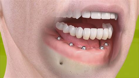 Tratamientos Clínica Dental Lago