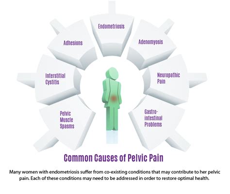 Common Causes Of Pelvic Pain Vital Health Endometriosis Center