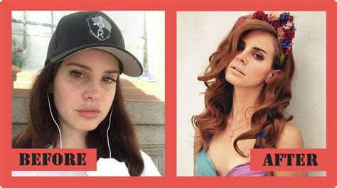 Lana Del Rey Plastic Surgery Antes Después