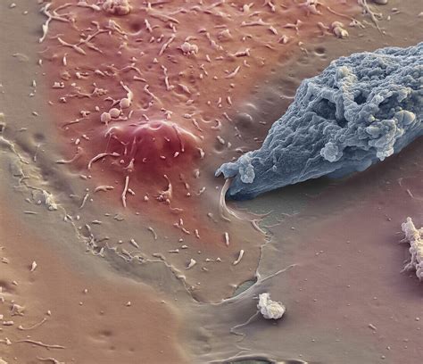 Entamoeba Protozoan Sem Bild Kaufen Science Photo Library