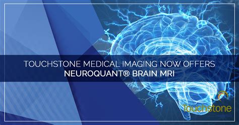 NeuroQuant® Brain MRI - Assessing Neurological Disease ...