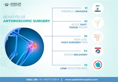 Arthroscopic Surgery Purpose Procedure Benefits Cost And Recovery