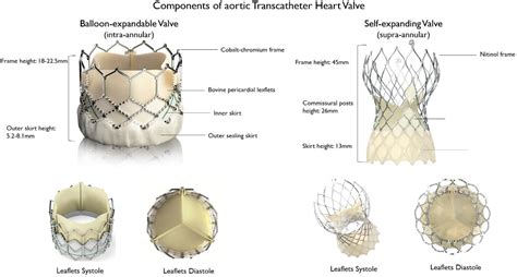 Types Of Transcatheter Aortic Valve Replacement Devices Encyclopedia Mdpi